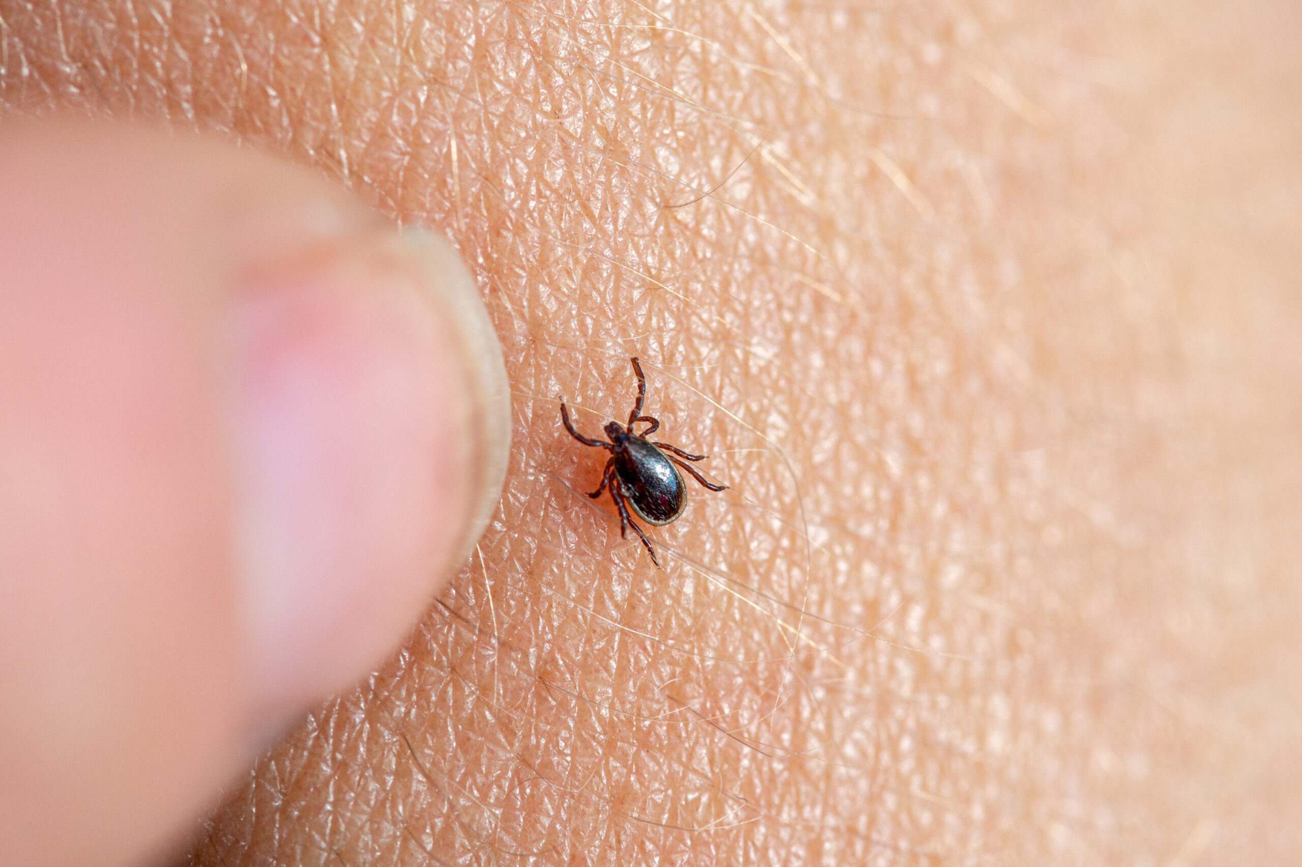 tick on human